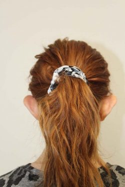 Before prominent ear correction